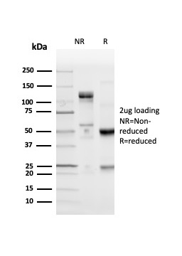 SDS-PAGE Analysis Purified PD-L1 Recombinant Rabbit Monoclonal Antibody (PDL1/4280R). Confirmation of Purity and Integrity of Antibody.