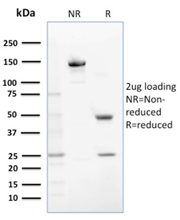 SDS-PAGE Analysis of Purified GSTM1 Mouse Monoclonal Antibody (GSTMu1-3). Confirmation of Purity and Integrity of Antibody.