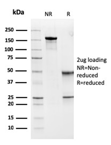 SDS-PAGE Analysis Purified MSH6 Mouse Monoclonal Antibody (MSH6/3091). Confirmation of Purity and Integrity of Antibody.