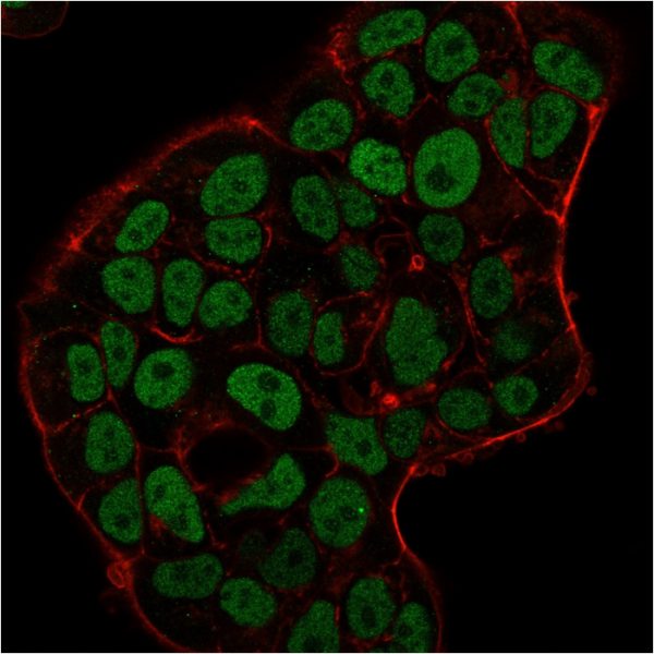 Immunofluorescence staining of MCF-7 cells using MSH6 Mouse Monoclonal Antibody (MSH6/3091) followed by goat anti-Mouse IgG conjugated to CF488 (green). Nuclei are stained with Reddot.