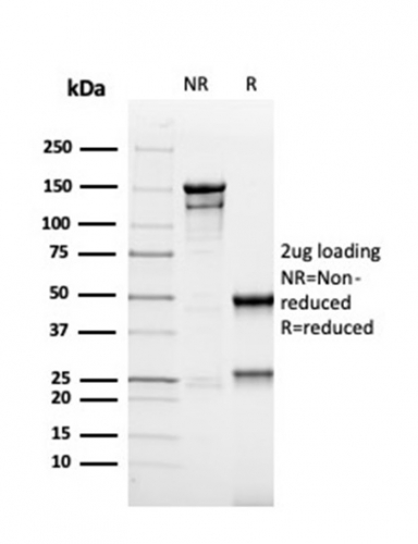 SDS-PAGE Analysis of Purified MSH6 Recombinant Mouse Monoclonal Antibody (rMSH6/4743). Confirmation of Purity and Integrity of Antibody. Recombinant MSH6 (DNA Mismatch Repair Protein) Antibody - Image 2