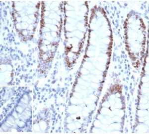 Formalin-fixed, paraffin-embedded human small intestine stained with MSH6 Recombinant Mouse Monoclonal Antibody (rMSH6/6846). Inset: PBS instead of primary antibody, secondary control.