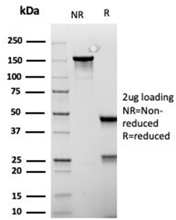 SDS-PAGE Analysis of Purified MSH6 Recombinant Mouse Monoclonal Antibody (rMSH6/6846). Confirmation of Integrity and Purity of Antibody.