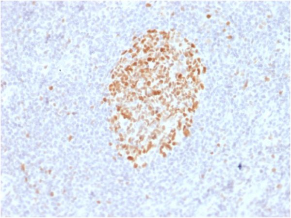 Formalin-fixed, paraffin-embedded human Lymph Node stained with MSH6 Mouse Monoclonal Antibody (MSH6/2927).