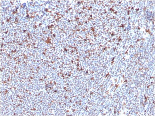 Formalin-fixed, paraffin-embedded human Tonsil stained with MSH6 Mouse Monoclonal Antibody (MSH6/3085).