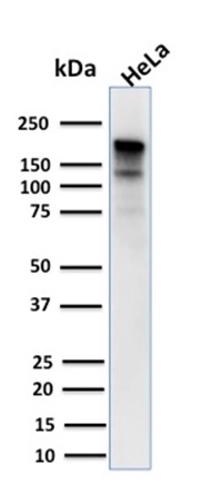 Western Blot Analysis of human HeLa cell lysate using MSH6 Mouse Monoclonal Antibody (MSH6/3085).