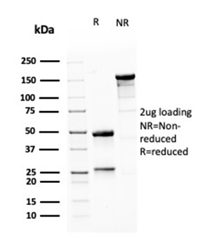 SDS-PAGE Analysis Purified MSH6 Mouse Monoclonal Antibody (MSH6/3085). Confirmation of Purity and Integrity of Antibody.