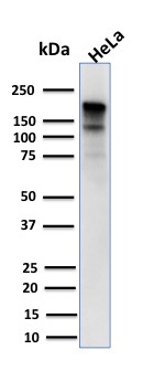 Western Blot Analysis of human HeLa cell lysate using MSH6 Mouse Monoclonal Antibody (MSH6/3085).