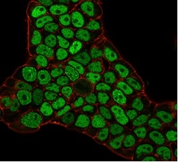 Immunofluorescence staining of PFA-fixed MCF-7 cells with MSH6 Mouse Monoclonal Antibody (MSH6/3086) followed by goat anti-mouse IgG-CF488 (green). Nuclei labeled with reddot.