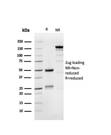 SDS-PAGE Analysis Purified MSH6 Mouse Monoclonal Antibody (MSH6/3086). Confirmation of Purity and Integrity of Antibody.