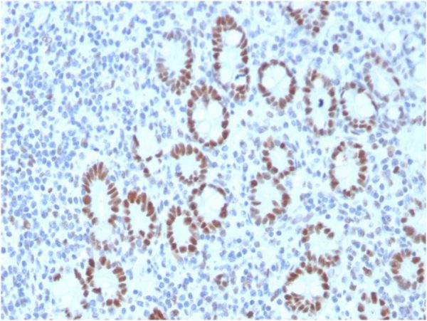 Formalin-fixed, paraffin-embedded human Small Intestine stained with MSH6 Mouse Monoclonal Antibody (MSH6/3089).