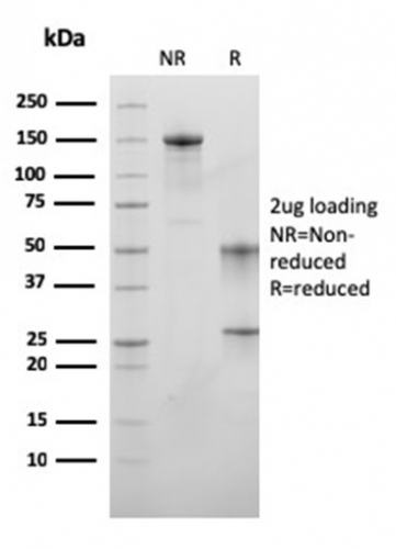 SDS-PAGE Analysis of Purified MSH6 Mouse Monoclonal Antibody (MSH6/3089). Confirmation of Purity and Integrity of Antibody.