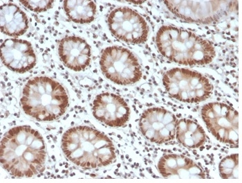 Formalin-fixed, paraffin-embedded human colon stained with MSH6 Recombinant Rabbit Monoclonal Antibody (MSH6/4592R).