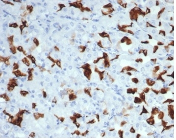 Formalin-fixed, paraffin-embedded human salivary gland stained with MSH6 Recombinant Rabbit Monoclonal Antibody (MSH6/7065R).