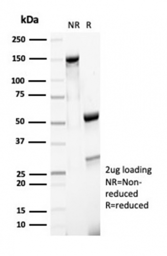 SDS-PAGE Analysis of Purified MSH6 Recombinant Rabbit Monoclonal Antibody (MSH6/7065R). Confirmation of Purity and Integrity of Antibody.