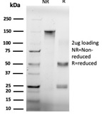 SDS-PAGE Analysis Purified GTF2H2 Mouse Monoclonal Antibody (PCRP-GTF2H2-1B9). Confirmation of Purity and Integrity of Antibody.