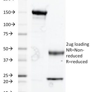 SDS-PAGE Analysis of Purified CD235a Mouse Monoclonal Antibody (A84-B/H2). Confirmation of Purity and Integrity of Antibody.