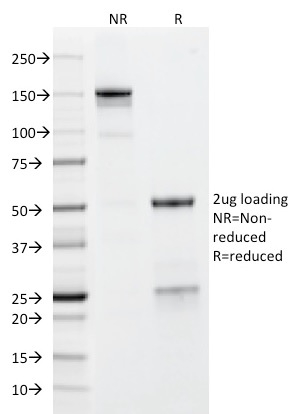 SDS-PAGE Analysis Purified Glycophorin A Mouse Monoclonal Antibody (GYPA/280). Confirmation of Integrity and Purity of Antibody.