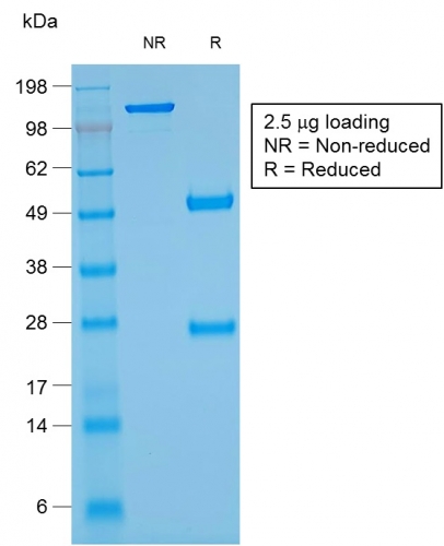 SDS-PAGE Analysis of Purified Glycophorin A Mouse Recombinant Monoclonal Ab (rGYPA/280). Confirmation of Purity and Integrity of Antibody.