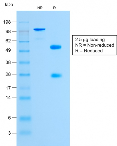 SDS-PAGE Analysis of Purified Glycophorin A Rabbit Monoclonal Antibody (GYPA/1725R). Confirmation of Purity and Integrity of Antibody.