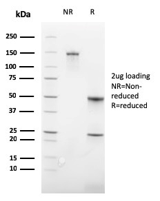 SDS-PAGE Analysis of Purified CD235a Recombinant Rabbit Monoclonal Antibody (GYPA/3219R). Confirmation of Integrity and Purity of Antibody.