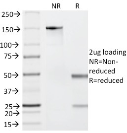 SDS-PAGE Analysis of Purified Granzyme B Mouse Monoclonal Antibody (GZMB/2403). Confirmation of Integrity and Purity of Antibody.