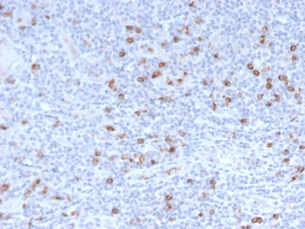 Formalin-fixed, paraffin-embedded human Tonsil stained with Granzyme B Monospecific Mouse Monoclonal Antibody (GZMB/3014).