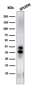 Western Blot Analysis of spleen tissue lysate using Granzyme B Mouse Monoclonal Antibody (GZMB/3014). Granzyme B (NK/T-Cell Lymphoma Marker) Antibody - Image 4