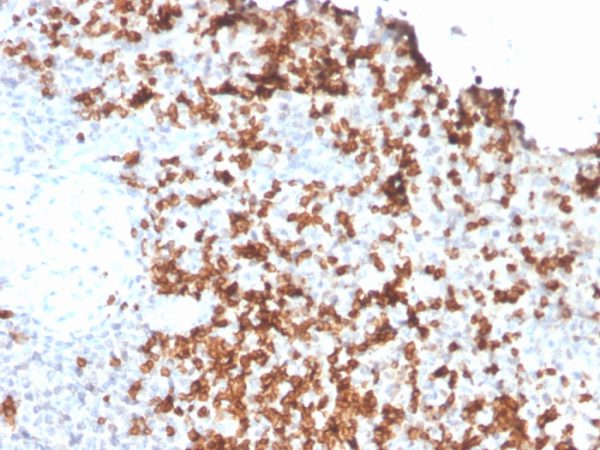 Formalin-fixed, paraffin-embedded human Spleen stained with Granzyme B Monospecific Mouse Monoclonal Antibody (GZMB/3056).