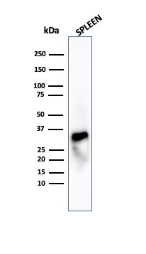 Western Blot Analysis of human spleen tissue lysate using Granzyme B Recombinant Rabbit Monoclonal Antibody (GZMB/4539R).