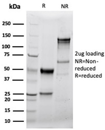 SDS-PAGE Analysis Purified GZMB Recombinant Rabbit Monoclonal Antibody (GZMB/4539R). Confirmation of Purity and Integrity of Antibody.