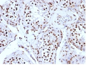 Formalin-fixed, paraffin-embedded human testicular carcinoma stained with Histone H1 Mouse Monoclonal Antibody (AE-4)