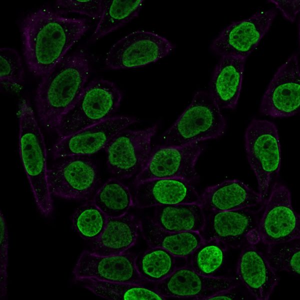 Confocal Immunofluorescence image of HeLa cells using Histone H1 Mouse Monoclonal Antibody (SPM256) (green-CF488). Phalloidin is used to label the membranes.