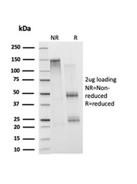 SDS-PAGE Analysis Purified Histone H1 Mouse Monoclonal Antibody (1415-1). Confirmation of Integrity and Purity of Antibody.