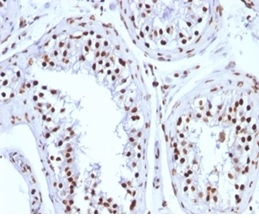 Formalin-fixed, paraffin-embedded human testicular carcinoma stained with Histone H1 Mouse Monoclonal Antibody (1415-1).