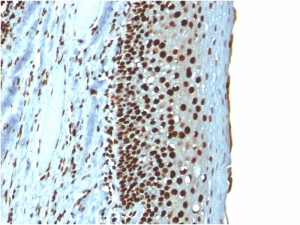 Formalin-fixed, paraffin-embedded human Tonsil stained with Histone H1 Mouse Recombinant Monoclonal Antibody (r1415-1).