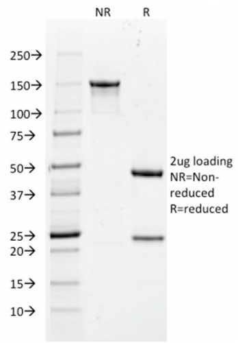 SDS-PAGE Analysis Purified Histone H1 Mouse Recombinant Monoclonal Antibody (rAE-4). Confirmation of Integrity and Purity of Antibody.