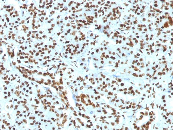 Formalin-fixed, paraffin-embedded human Pancreas stained with Histone H1 Rabbit Recombinant Monoclonal Antibody (HH1/1784R).