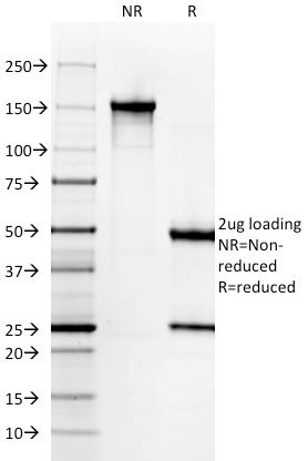 SDS-PAGE Analysis Purified Histone H1 Rabbit Recombinant Monoclonal Antibody (AE-4). Confirmation of Purity and Integrity of Antibody.