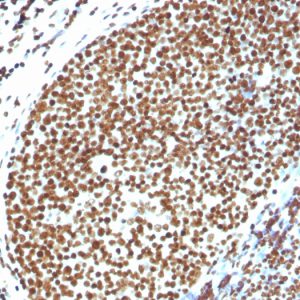 Formalin-fixed, paraffin-embedded human Tonsil stained with Histone H1 Rabbit Polyclonal Antibody.