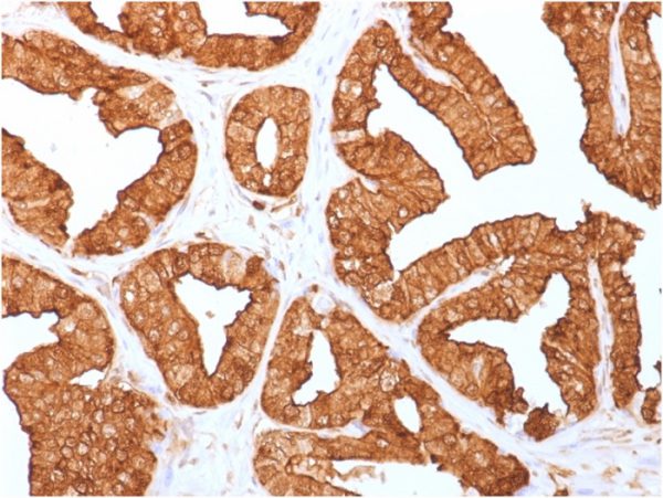 Formalin-fixed, paraffin-embedded human Prostate tissue stained with Annexin A1 Mouse Monoclonal Antibody (ANXA1/1671).