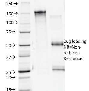 SDS-PAGE Analysis Purified Annexin A1 Mouse Monoclonal Antibody (ANEX 5E4/1). Confirmation of Integrity and Purity of the Antibody.