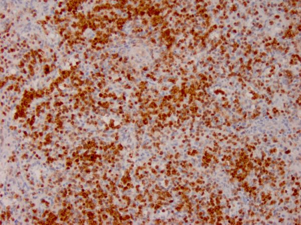 Formalin-fixed, paraffin-embedded human Lymph Node stained withAnnexin A1 Mouse Monoclonal Antibody (ANXA1/3566).