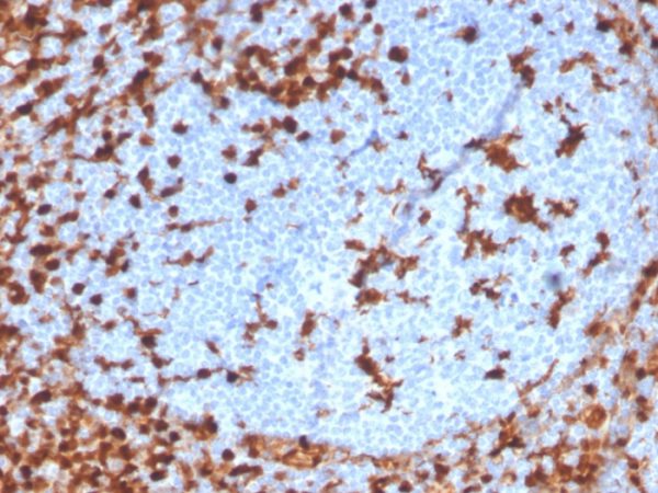 Formalin-fixed, paraffin-embedded human tonsil stained with Annexin A1 Recombinant Rabbit Monoclonal Antibody (ANXA1/3869R).