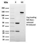 SDS-PAGE Analysis of Purified CD209 Mouse Monoclonal Antibody (C209/6774). Confirmation of Purity and Integrity of Antibody.