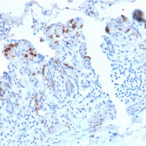 Formalin-fixed, paraffin-embedded human Small Intestine stained with CD209 Recombinant Rabbit Monoclonal Antibody (C209/2749R).