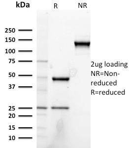 SDS-PAGE Analysis of Purified Heregulin-1 Mouse Monoclonal Antibody (NRG1/2752). Confirmation of Purity and Integrity of Antibody.