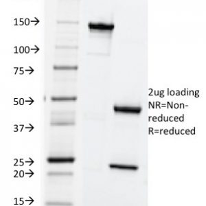 SDS-PAGE Analysis of Purified HLA-ABC Mouse Monoclonal Antibody (SPM419). Confirmation of Purity and Integrity of Antibody.