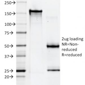 SDS-PAGE Analysis of Purified HLA-A Mouse Monoclonal Antibody (108-2C5). Confirmation of Purity and Integrity of Antibody.