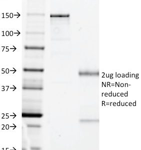 SDS-PAGE Analysis Purified HLA-DP Mouse Monoclonal Antibody (BRA-FB6). Confirmation of Integrity and Purity of Antibody.